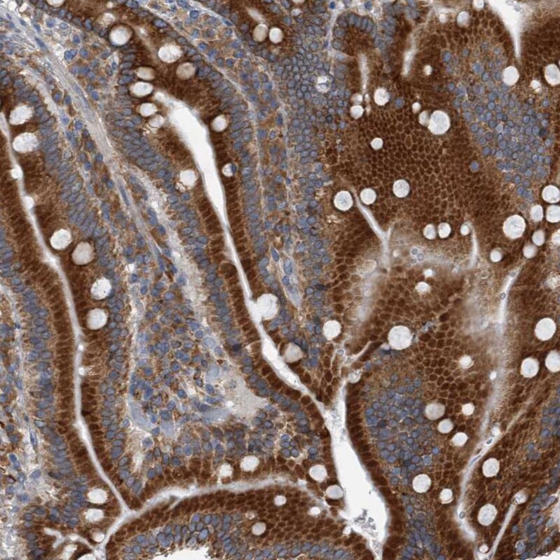 CCDC47 Antibody - BSA Free Immunohistochemistry-Paraffin: CCDC47 Antibody [NBP1-93717]