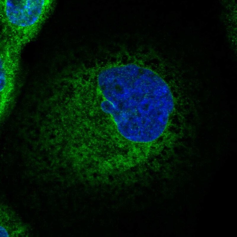 CCDC47 Antibody - BSA Free Immunocytochemistry/ Immunofluorescence: CCDC47 Antibody - BSA Free [NBP1-93717]