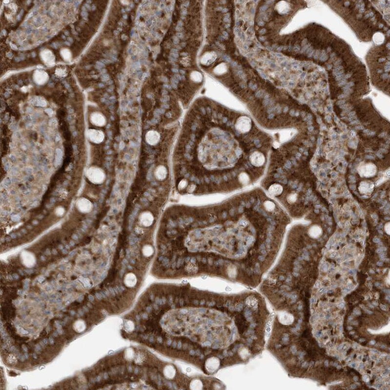 GOLGA4 Antibody - BSA Free Immunohistochemistry: GOLGA4 Antibody - BSA Free [NBP1-93719]