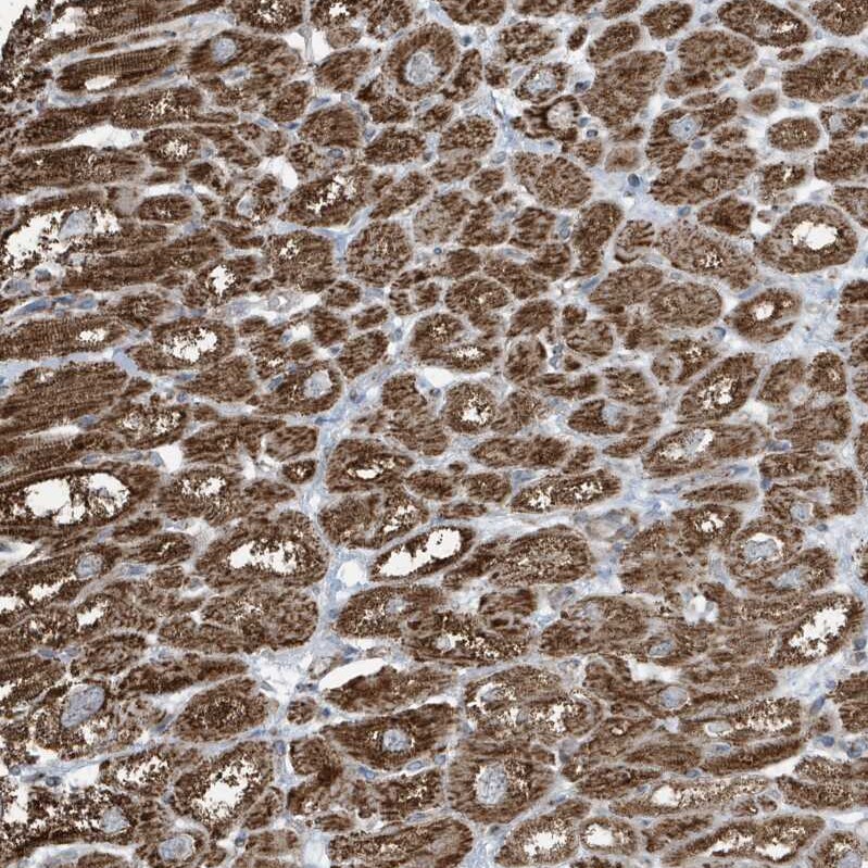 GOLGA4 Antibody - BSA Free Immunohistochemistry: GOLGA4 Antibody - BSA Free [NBP1-93719]