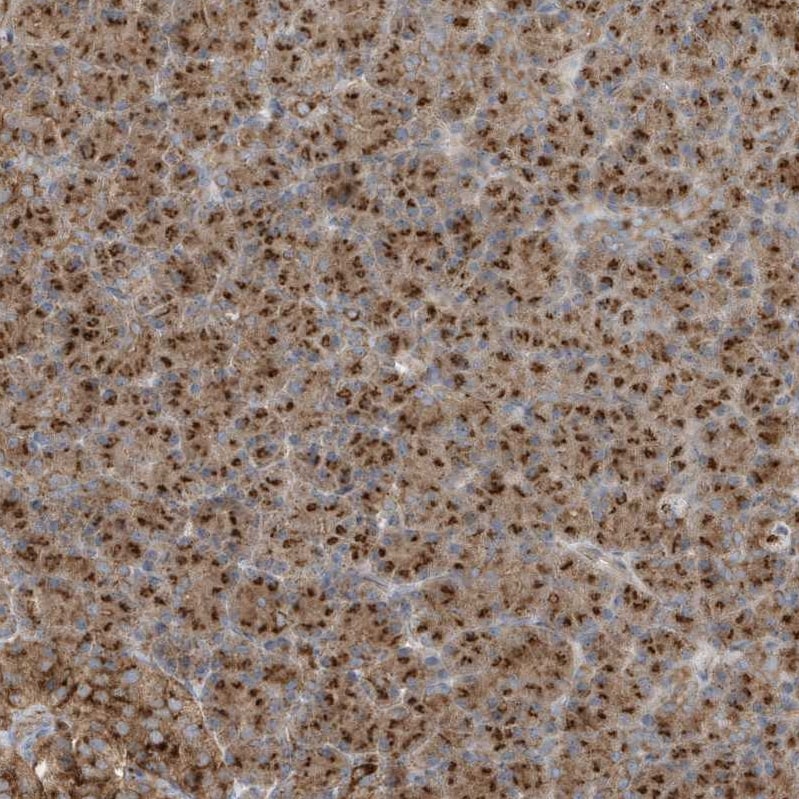 GOLGA4 Antibody - BSA Free Immunohistochemistry: GOLGA4 Antibody - BSA Free [NBP1-93719]