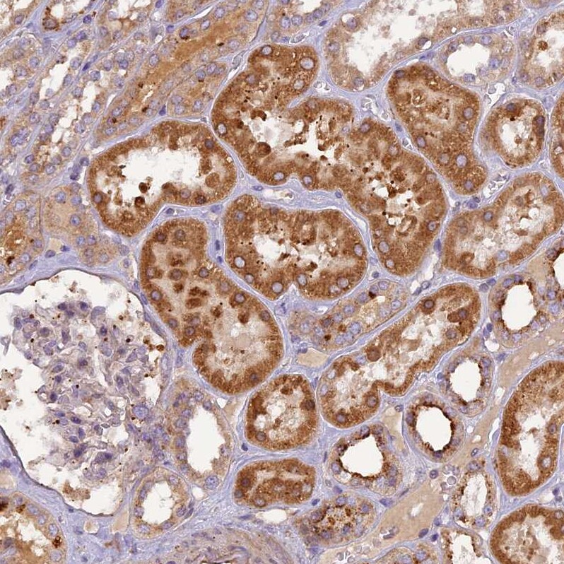 FNIP2 Antibody - BSA Free Immunohistochemistry: FNIP2 Antibody - BSA Free [NBP1-93724]