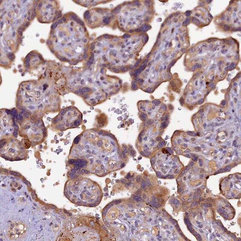 FNIP2 Antibody - BSA Free Immunohistochemistry: FNIP2 Antibody - BSA Free [NBP1-93724]