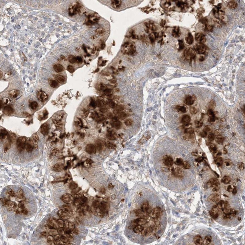 PRSS36 Antibody - BSA Free Immunohistochemistry: PRSS36 Antibody - BSA Free [NBP1-93725]