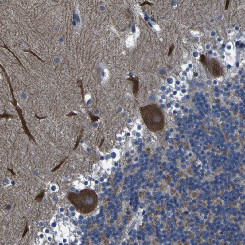 GRAMD1A Antibody - BSA Free Immunohistochemistry: GRAMD1A Antibody - BSA Free [NBP1-93729]