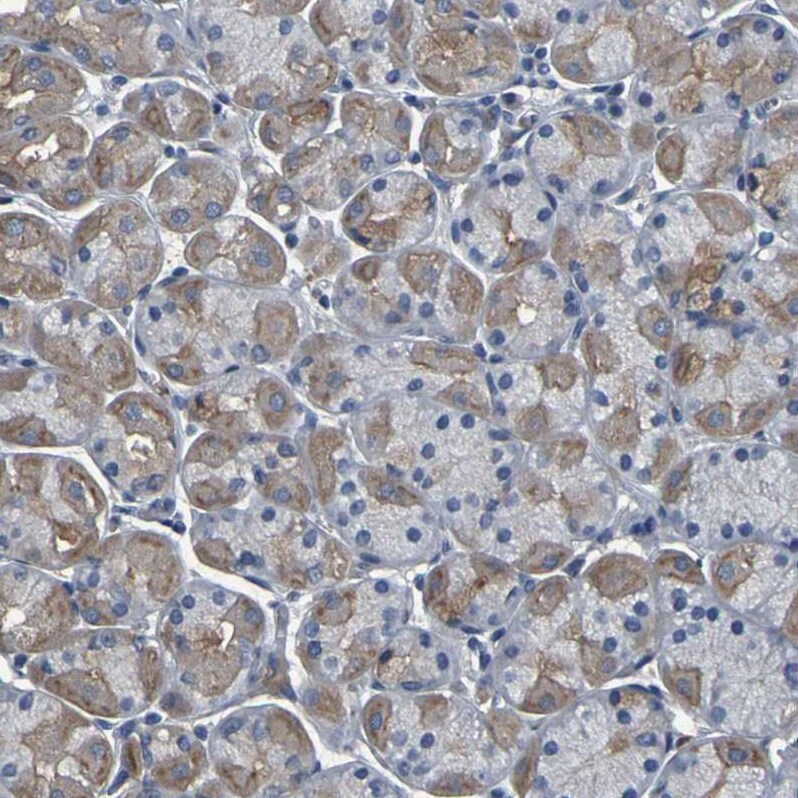 GRAMD1A Antibody - BSA Free Immunohistochemistry: GRAMD1A Antibody - BSA Free [NBP1-93729]