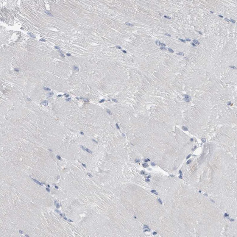 FAM83H Antibody - BSA Free Immunohistochemistry: FAM83H Antibody - BSA Free [NBP1-93737]
