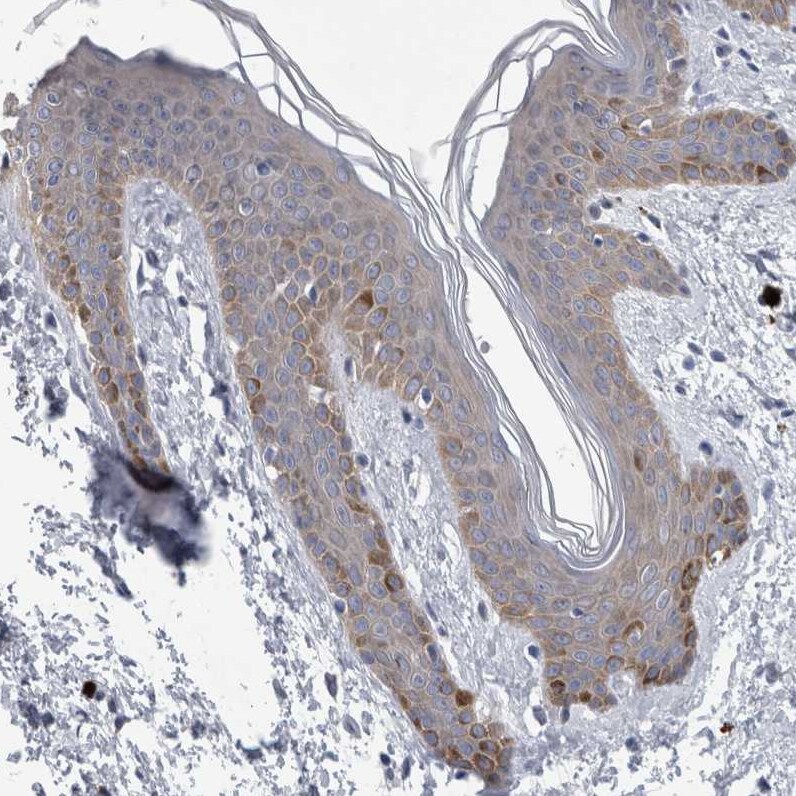 FAM83H Antibody - BSA Free Immunohistochemistry: FAM83H Antibody - BSA Free [NBP1-93737]