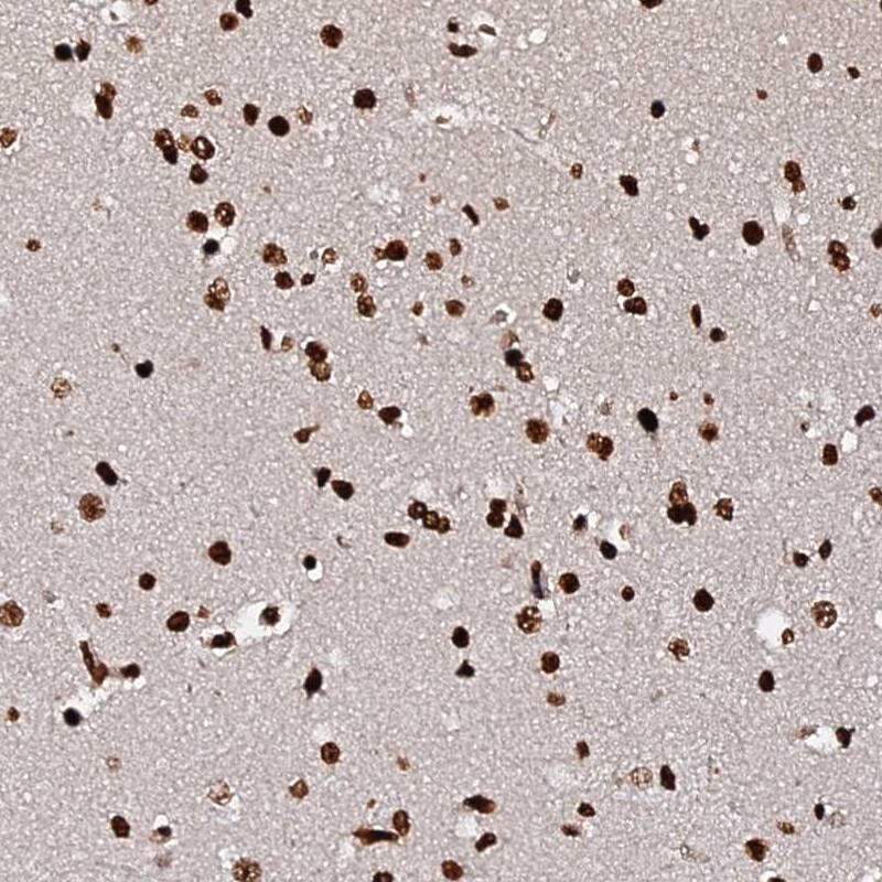 DNAH10OS Antibody - BSA Free Immunohistochemistry: DNAH10OS Antibody - BSA Free [NBP1-93748]