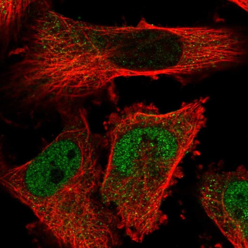 TMPPE Antibody - BSA Free Immunocytochemistry/ Immunofluorescence: TMPPE Antibody - BSA Free [NBP1-93749]
