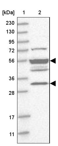 TMPPE Antibody - BSA Free Western Blot: TMPPE Antibody - BSA Free [NBP1-93749]