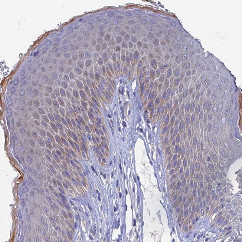 SPIN4 Antibody - BSA Free Immunohistochemistry: SPIN4 Antibody - BSA Free [NBP1-93750]