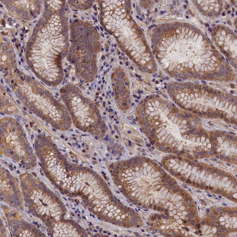 CCDC9B Antibody - BSA Free Immunohistochemistry-Paraffin: CCDC9B Antibody [NBP1-93763]