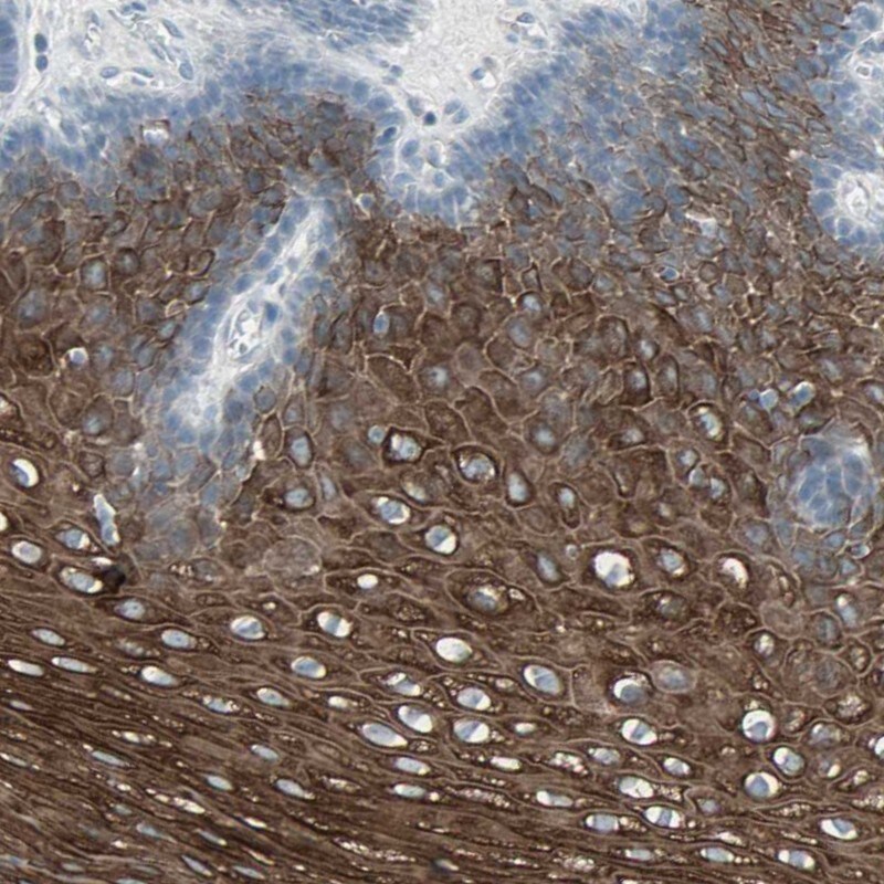 LANCL3 Antibody - BSA Free Immunohistochemistry: LANCL3 Antibody - BSA Free [NBP1-93767]