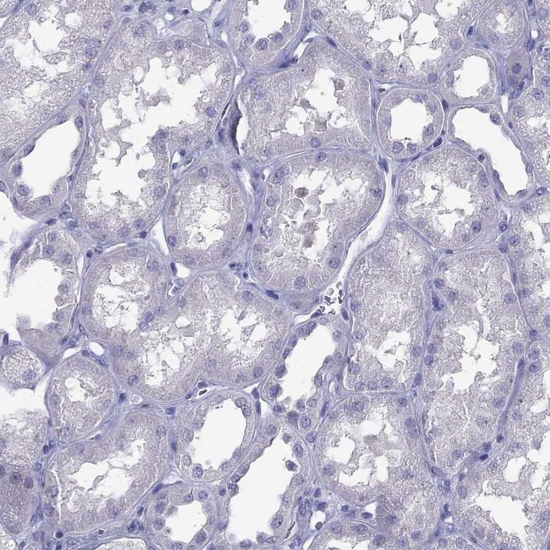 IL17REL Antibody - BSA Free Immunohistochemistry: IL17REL Antibody - BSA Free [NBP1-93769]