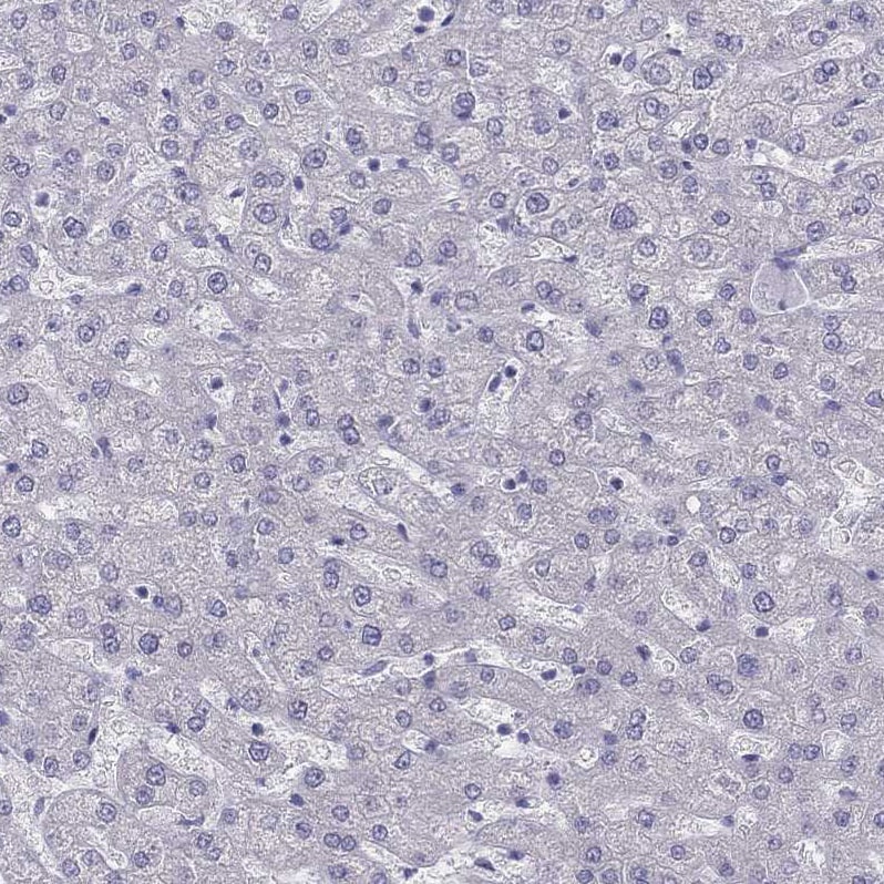 IL17REL Antibody - BSA Free Immunohistochemistry: IL17REL Antibody - BSA Free [NBP1-93769]