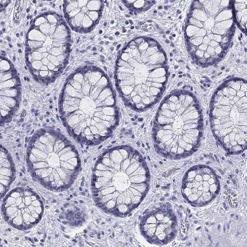 IL17REL Antibody - BSA Free Immunohistochemistry: IL17REL Antibody - BSA Free [NBP1-93769]