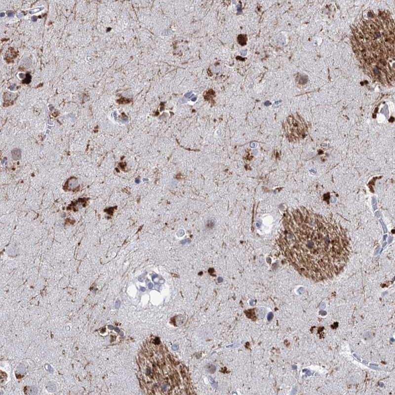 C16orf72 Antibody - BSA Free Immunohistochemistry-Paraffin: C16orf72 Antibody [NBP1-93773]