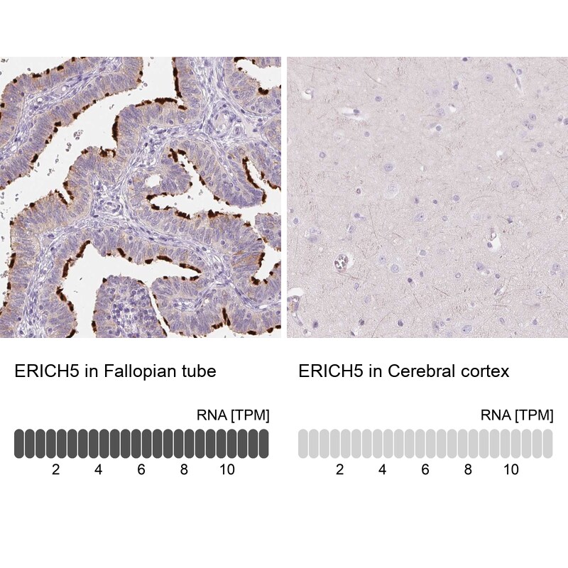 Glutamate Rich 5 Antibody - BSA Free Immunohistochemistry: Glutamate Rich 5 Antibody - BSA Free [NBP1-93788]