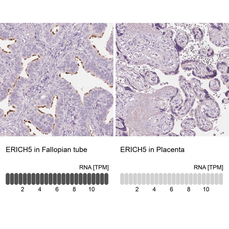 Glutamate Rich 5 Antibody - BSA Free Immunohistochemistry: Glutamate Rich 5 Antibody - BSA Free [NBP1-93789]