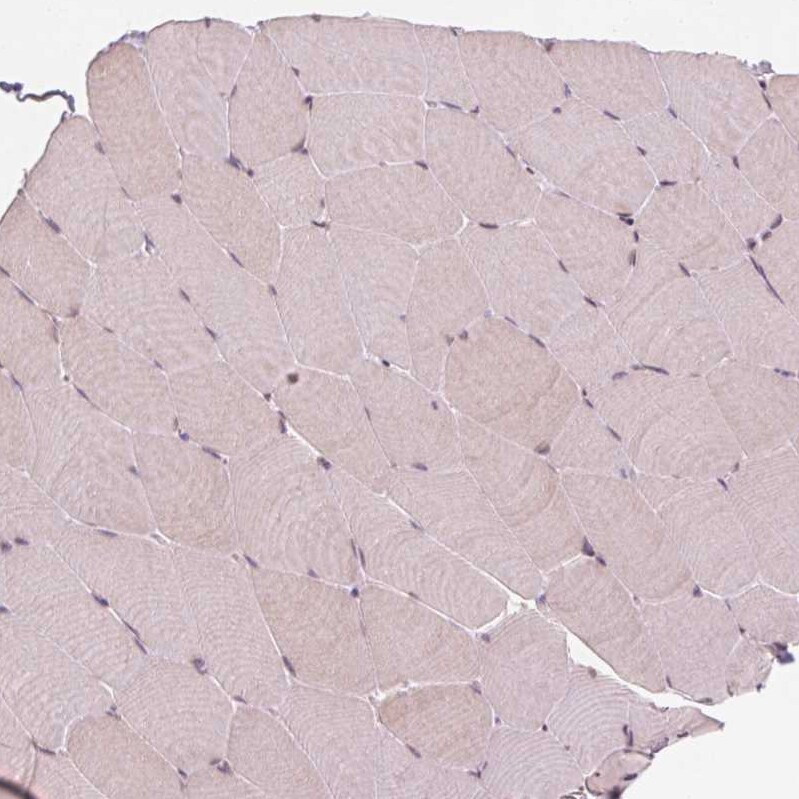 Glutamate Rich 5 Antibody - BSA Free Immunohistochemistry: Glutamate Rich 5 Antibody - BSA Free [NBP1-93790]