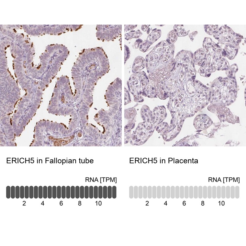 Glutamate Rich 5 Antibody - BSA Free Immunohistochemistry: Glutamate Rich 5 Antibody - BSA Free [NBP1-93790]