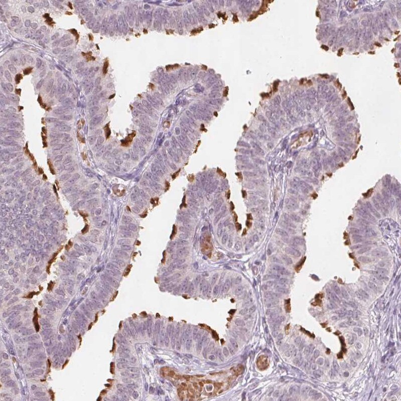 Glutamate Rich 5 Antibody - BSA Free Immunohistochemistry: Glutamate Rich 5 Antibody - BSA Free [NBP1-93790]