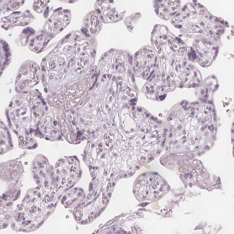 Glutamate Rich 5 Antibody - BSA Free Immunohistochemistry: Glutamate Rich 5 Antibody - BSA Free [NBP1-93790]