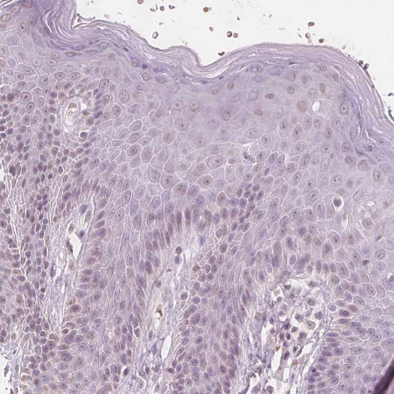 Glutamate Rich 5 Antibody - BSA Free Immunohistochemistry: Glutamate Rich 5 Antibody - BSA Free [NBP1-93790]