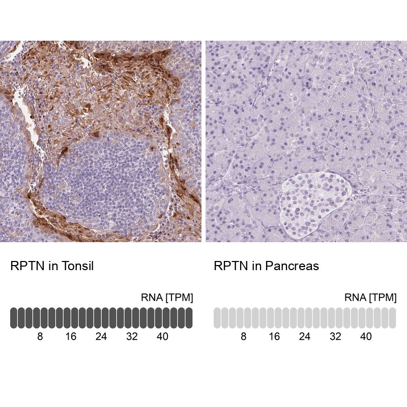 RPTN Antibody - BSA Free Immunohistochemistry-Paraffin: RPTN Antibody [NBP1-93792]