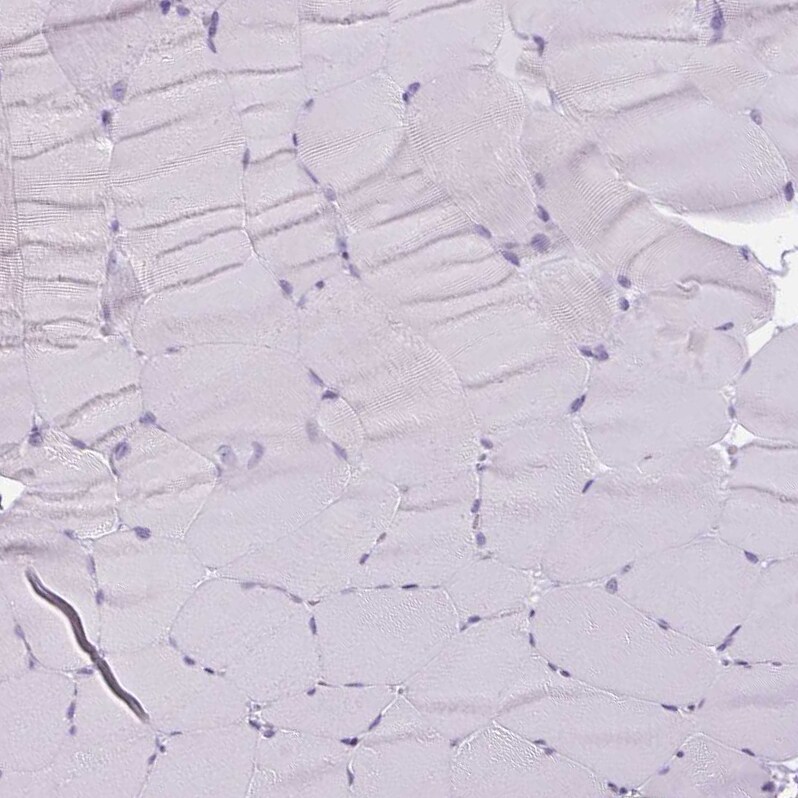RPTN Antibody - BSA Free Immunohistochemistry-Paraffin: RPTN Antibody [NBP1-93792]