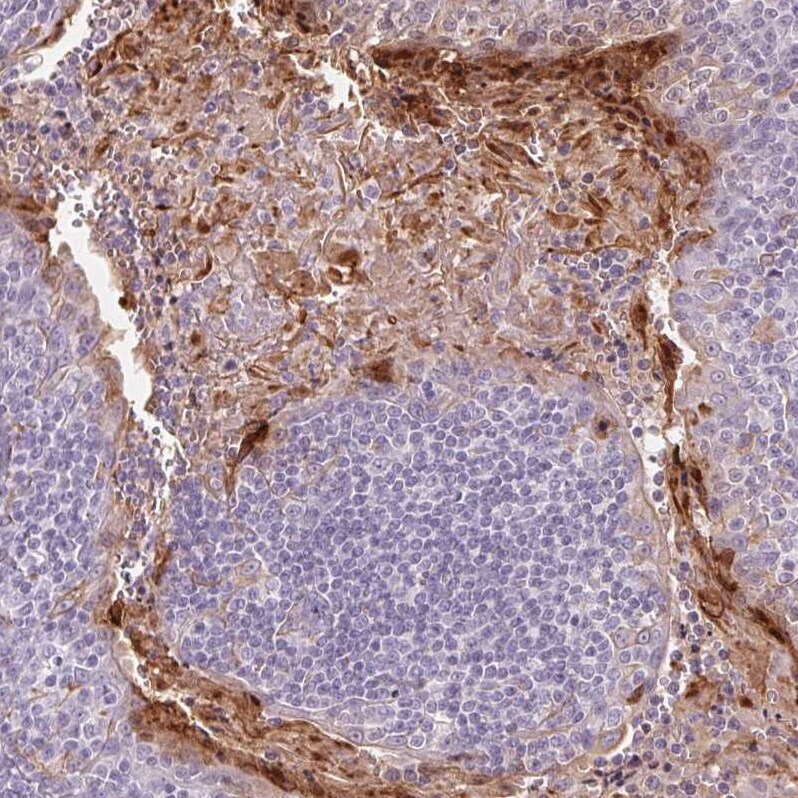 RPTN Antibody - BSA Free Immunohistochemistry-Paraffin: RPTN Antibody [NBP1-93792]