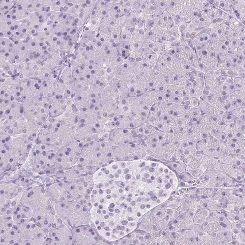 RPTN Antibody - BSA Free Immunohistochemistry-Paraffin: RPTN Antibody [NBP1-93792]