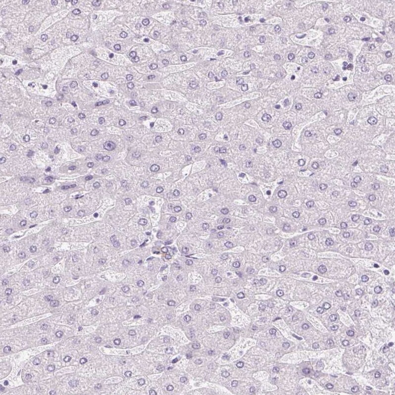 RPTN Antibody - BSA Free Immunohistochemistry: RPTN Antibody - BSA Free [NBP1-93792]
