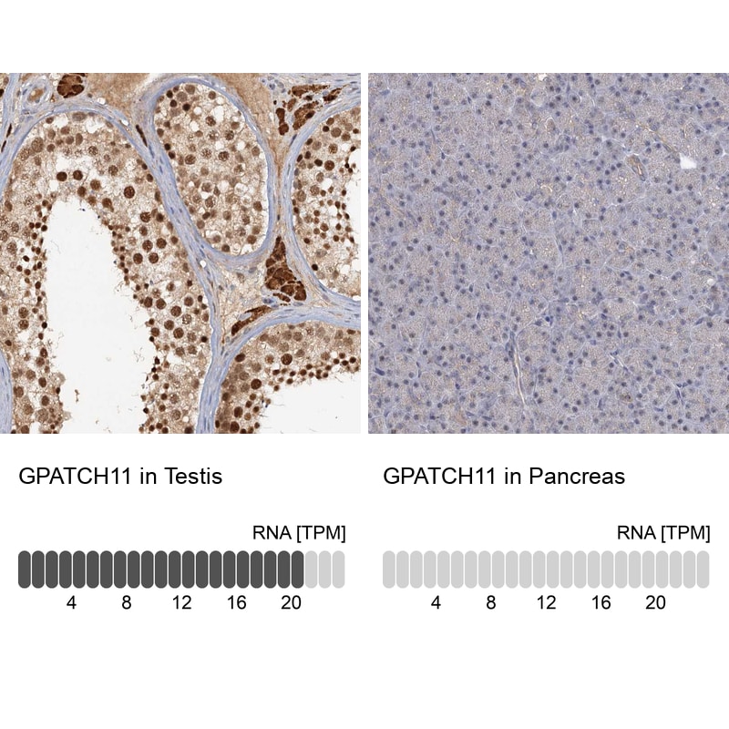 CCDC75 Antibody - BSA Free Immunohistochemistry: CCDC75 Antibody - BSA Free [NBP1-93801]