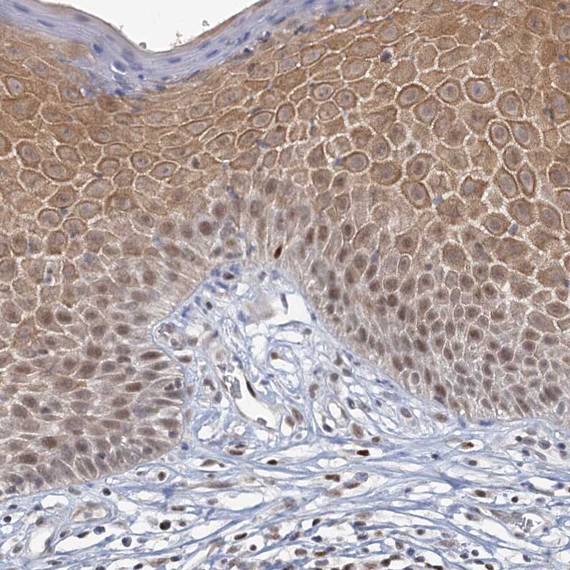 CCDC75 Antibody - BSA Free Immunohistochemistry: CCDC75 Antibody - BSA Free [NBP1-93801]