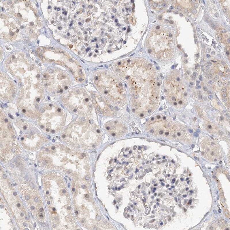 CCDC75 Antibody - BSA Free Immunohistochemistry: CCDC75 Antibody - BSA Free [NBP1-93801]