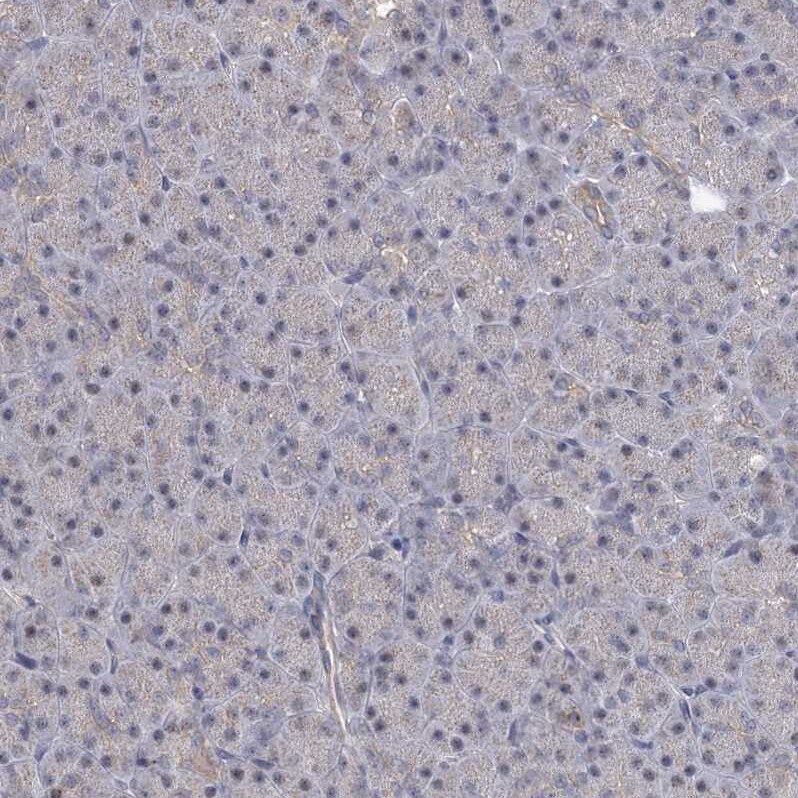 CCDC75 Antibody - BSA Free Immunohistochemistry: CCDC75 Antibody - BSA Free [NBP1-93801]
