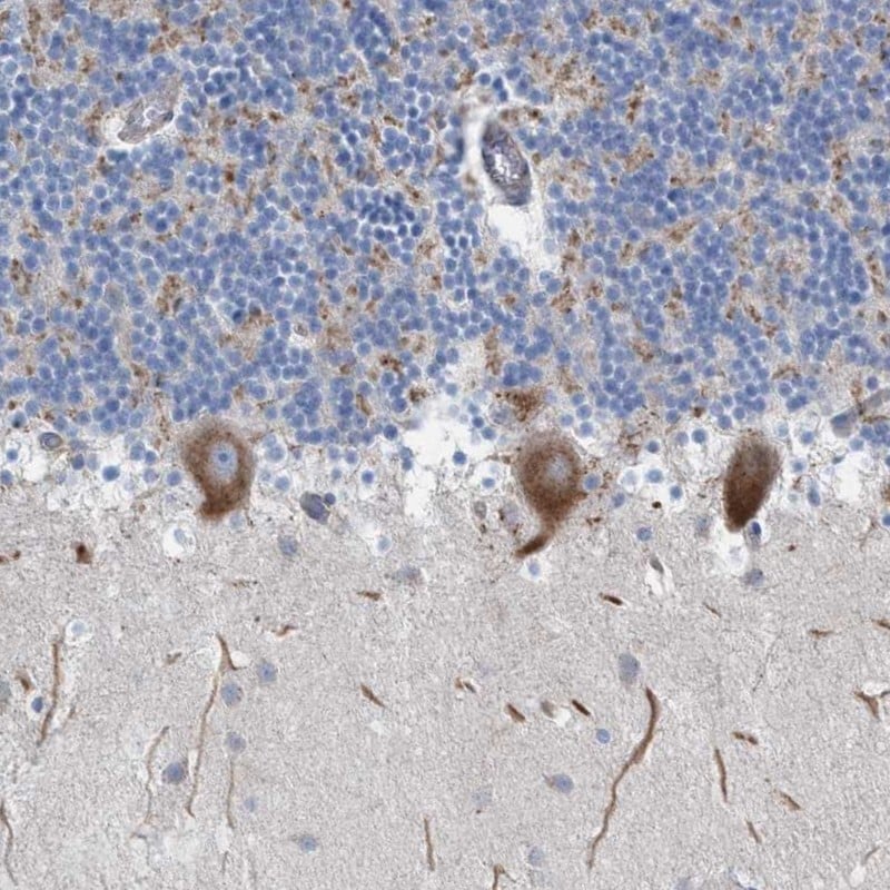 NYAP1 Antibody - BSA Free Immunohistochemistry: NYAP1 Antibody - BSA Free [NBP1-93806]