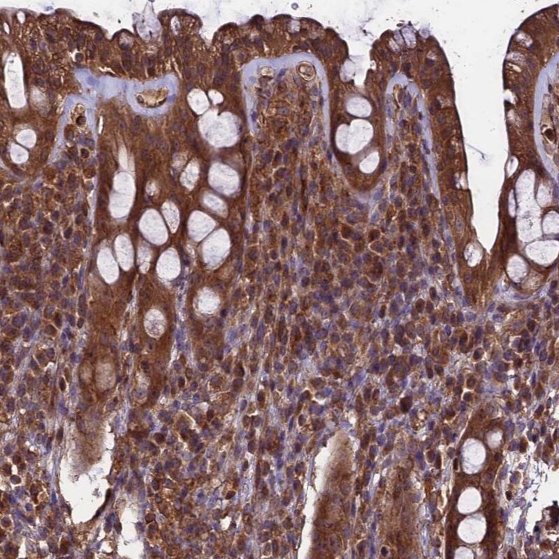 TTLL10 Antibody - BSA Free Immunohistochemistry: TTLL10 Antibody - BSA Free [NBP1-93819]