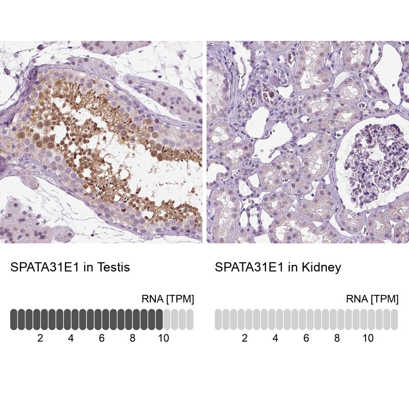 SPATA31E1 Antibody - BSA Free Immunohistochemistry: SPATA31E1 Antibody - BSA Free [NBP1-93822]