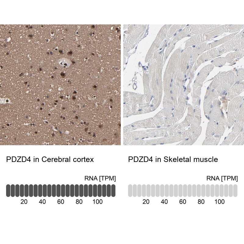 PDZD4 Antibody - BSA Free Immunohistochemistry: PDZD4 Antibody - BSA Free [NBP1-93845]