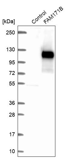 FAM171B Antibody - BSA Free Western Blot: FAM171B Antibody - BSA Free [NBP1-93846]
