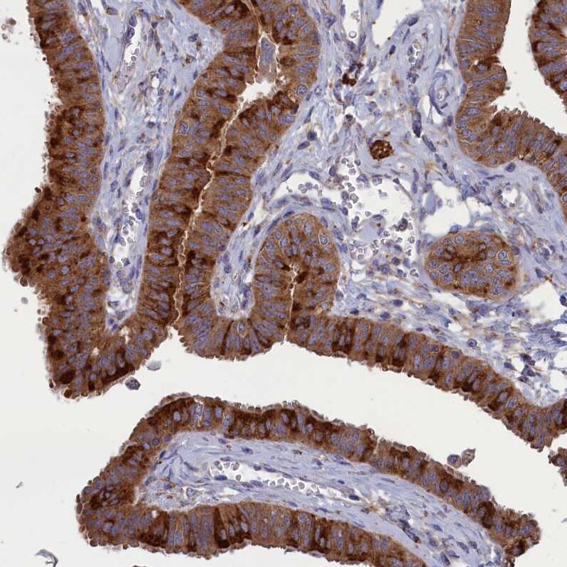 SCAMP4 Antibody - BSA Free Immunohistochemistry: SCAMP4 Antibody - BSA Free [NBP1-93849]