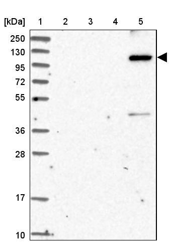 KIAA1468 Antibody - BSA Free Western Blot: KIAA1468 Antibody - BSA Free [NBP1-93850]