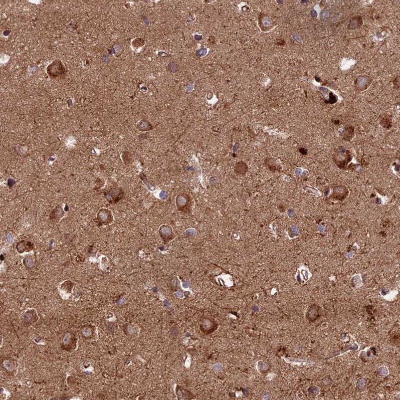 KIAA1468 Antibody - BSA Free Immunohistochemistry: KIAA1468 Antibody - BSA Free [NBP1-93851]