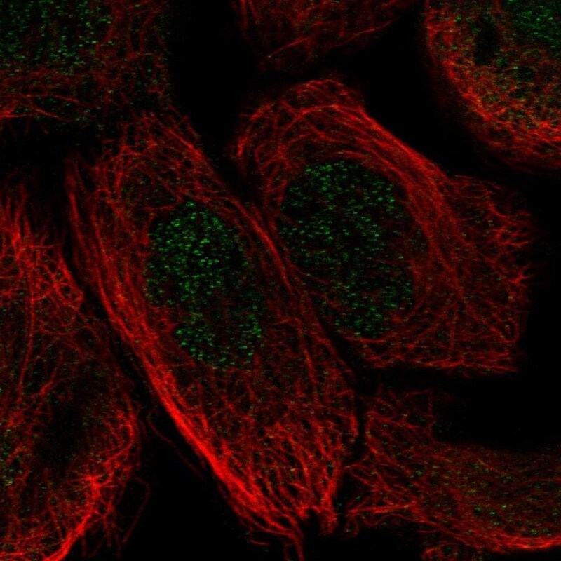 KY Antibody - BSA Free Immunocytochemistry/ Immunofluorescence: KY Antibody - BSA Free [NBP1-93859]