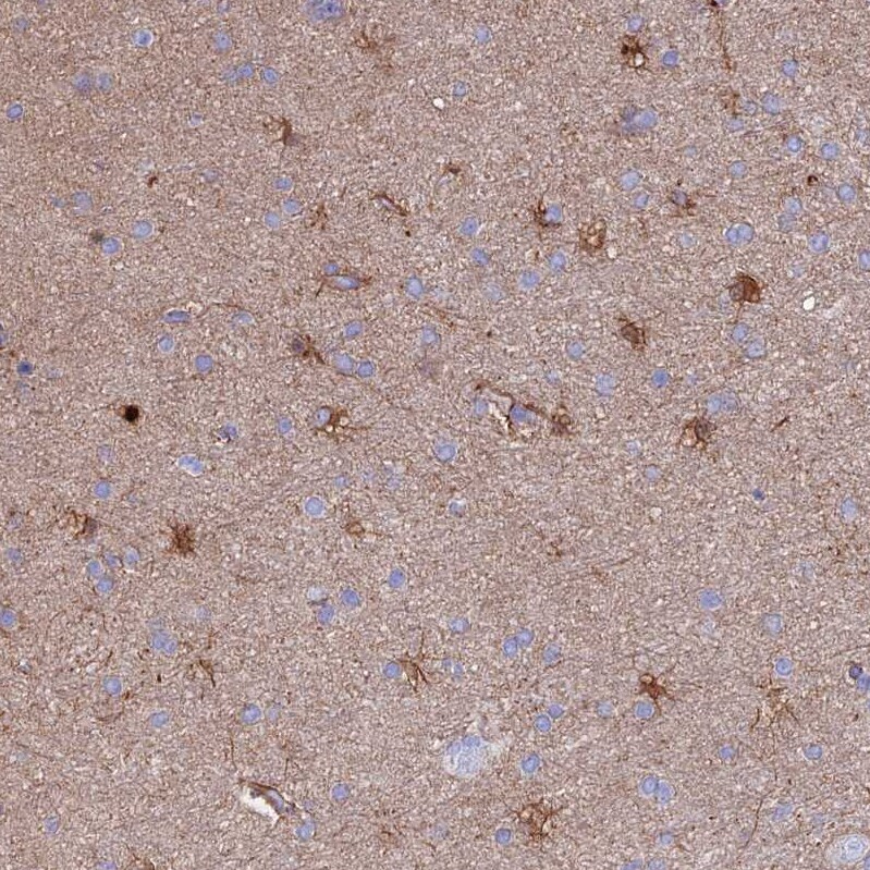 CLEC2L Antibody - BSA Free Immunohistochemistry: CLEC2L Antibody - BSA Free [NBP1-93861]