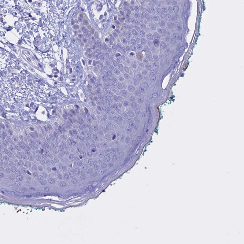 CLEC2L Antibody - BSA Free Immunohistochemistry: CLEC2L Antibody - BSA Free [NBP1-93861]