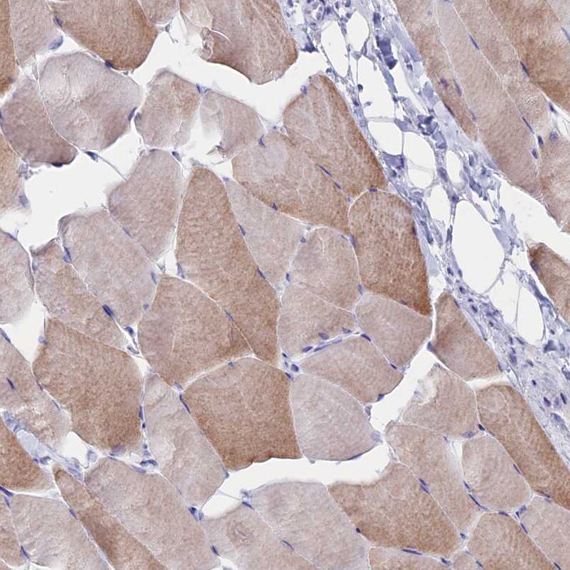 CLEC2L Antibody - BSA Free Immunohistochemistry: CLEC2L Antibody - BSA Free [NBP1-93861]